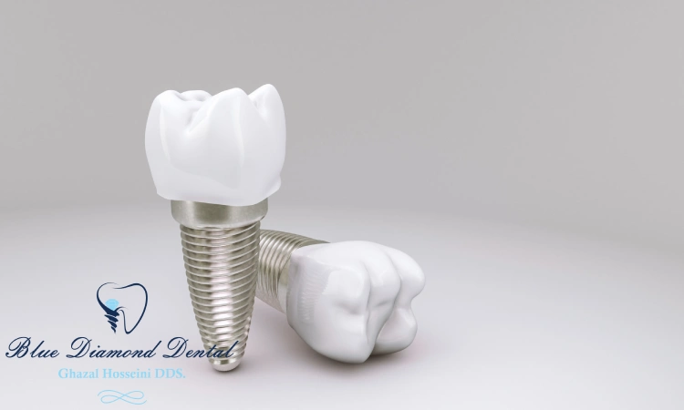 Why put a crown on an implant?