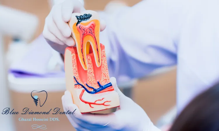 What is considered root canal therapy?