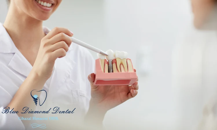Is root canal therapy the same as a root canal?