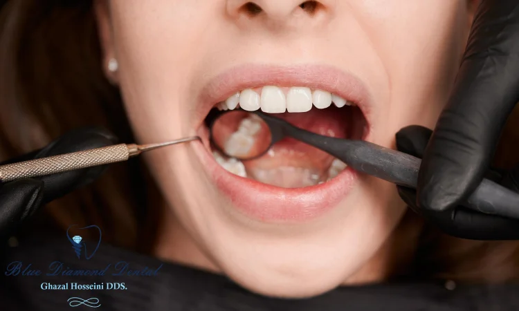 Is teeth grinding a serious problem?