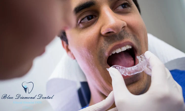 How long is the treatment for Invisalign?