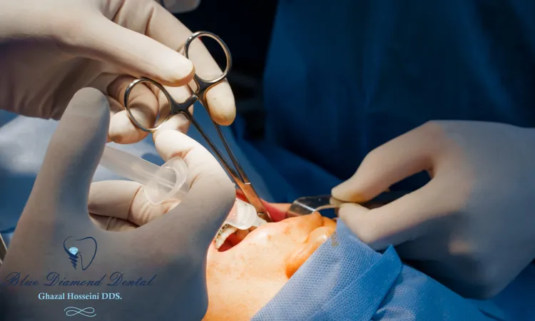 What are the four categories of surgical procedures?