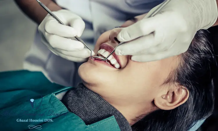 How long do fillings last in teeth?