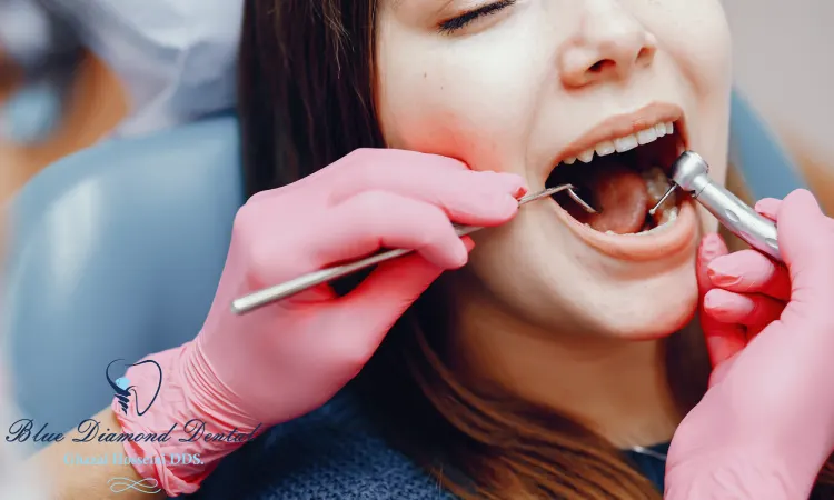 How long do dental sealants last?