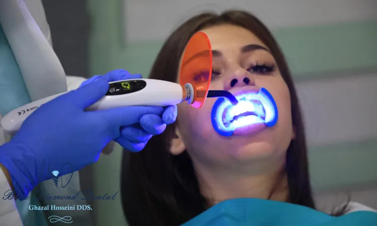 Does Zoom whitening work?