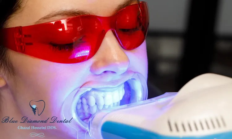 What does Zoom whitening cost?