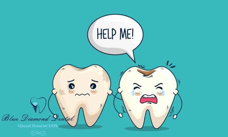 How to Care for a Chipped or Broken Tooth
