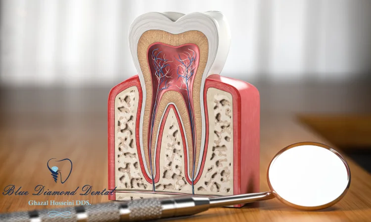 Benefits of a Root Canal