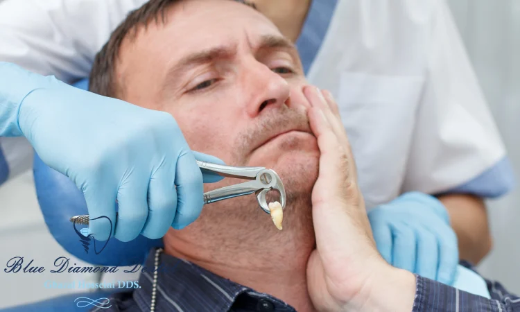 How long does it take to recover from wisdom tooth extraction?