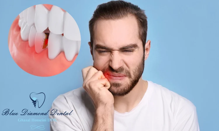 side effects and complications of teeth grinding
