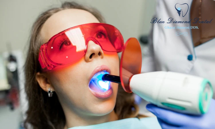 Can a dentist bleach your teeth?