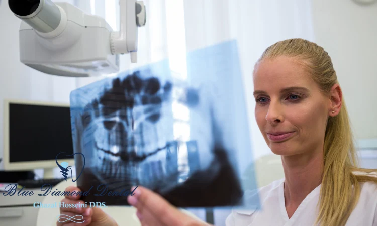 CBCT Technology and Procedure