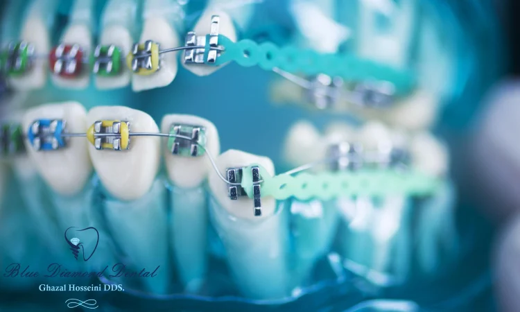 The Importance of Selecting the Right Orthodontist